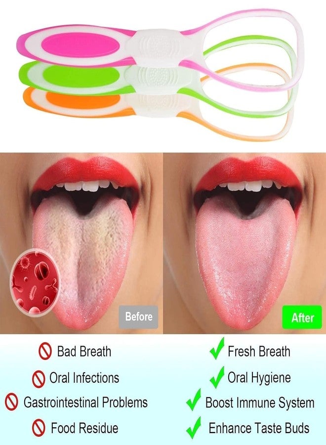Skab® Plastic Tongue Cleaner/Tongue Scraper for Healthy Oral Care and Adults Kids, Easy to Use, Help Fight Bad Breath Travel Friendly (Set Of 1, Random Color) - Image 4